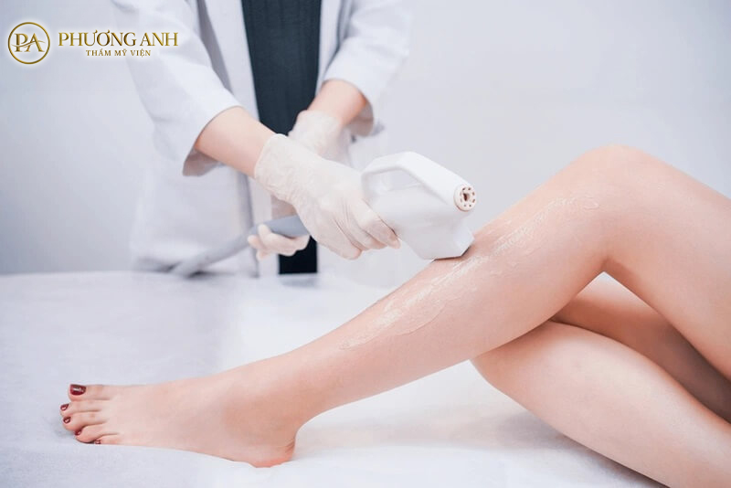 nano laser triet long vung bikini 1